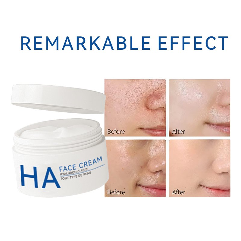 Enjoy Skin Hyaluronic Acid Moisturizer Face Cream Moisturizing Smooth Soft Hydrate Anti Wrinkle Face Cream With Vitamin C