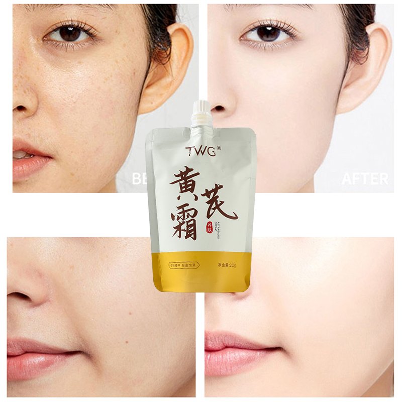 TWG Acne Mark Removal Face Cream & Lotion Skin Brightening Lightening Spot Beauty Salon Astragalus Whitening Face Cream