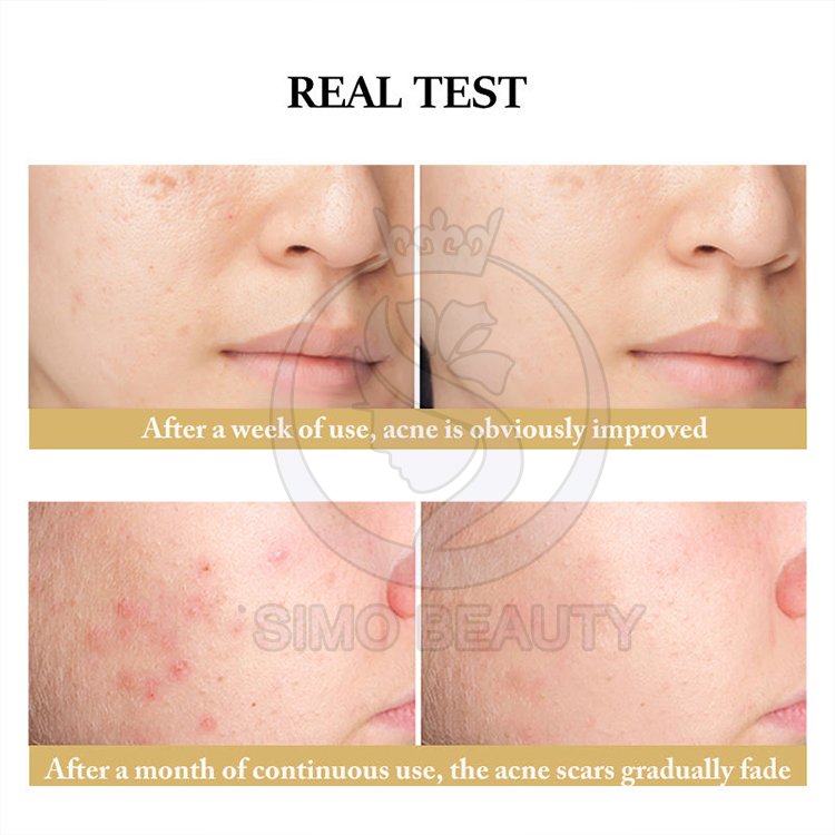 Skin glow meso cream collagen mesotherapy solution