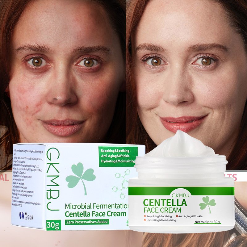 microbial fermented skin care,sensitive licorice surgery swelling acne removal,repairing whitening centella soothing face cream