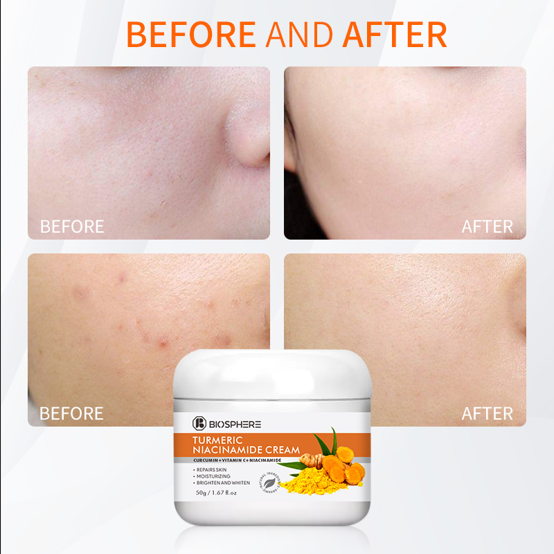 Halal Approved Skin Bleaching Cream Whitening Anti-Oxidation Moisturizer Turmeric Korean Whitening Creams For Face And Body