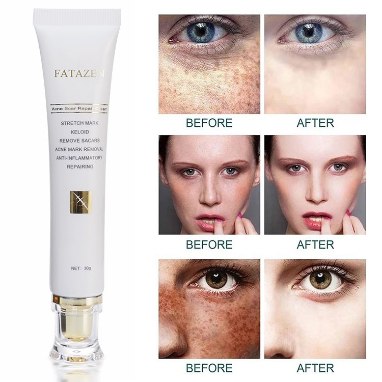 FATAZEN Herbal Effective Skin Repairing Gel Natural Acne Pimple Mark Stretch Marks Scar Removing Cream