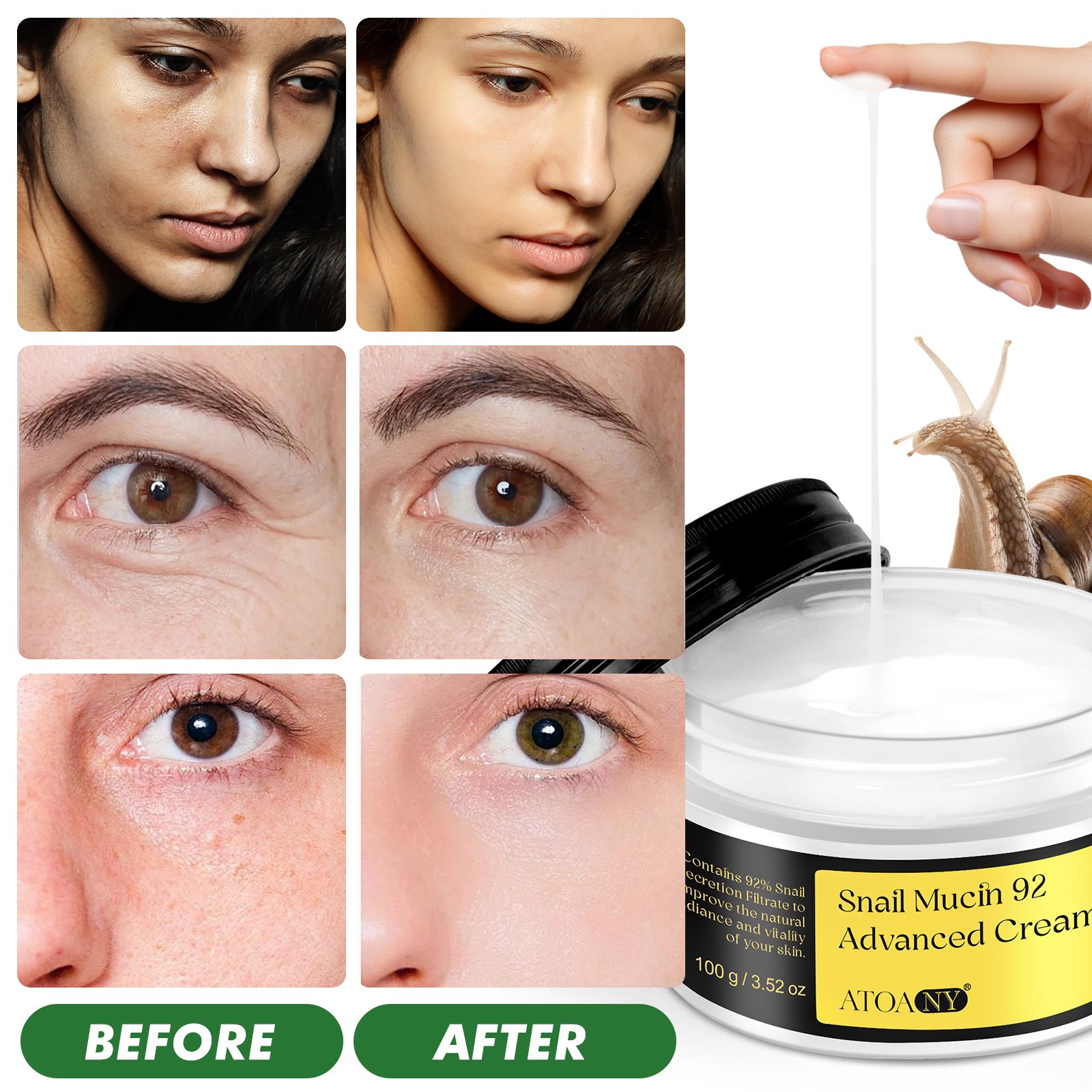 Korean 100g Snail Mucin 92% Advanced Cream Private Label Daily Face Gel Moisturizer Mucin Skin Bleaching Whitening Snail Cream