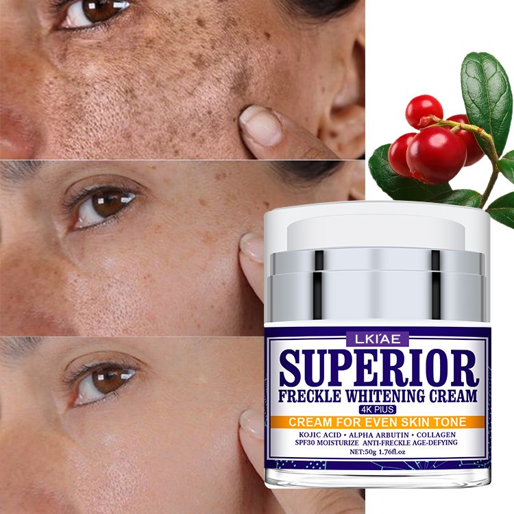 Private Label Skin Powerful Whitening Freckle Removal Face Bleaching Cream