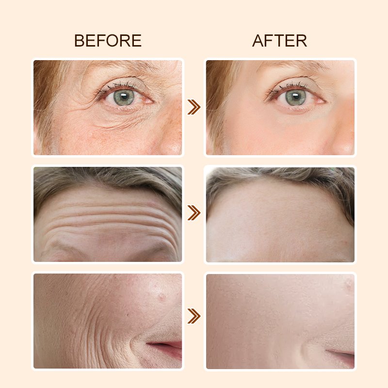 Custom logo Retinol face cream private label organic Vegan Anti Aging Wrinkle Removal Dark Spot whitening face cream