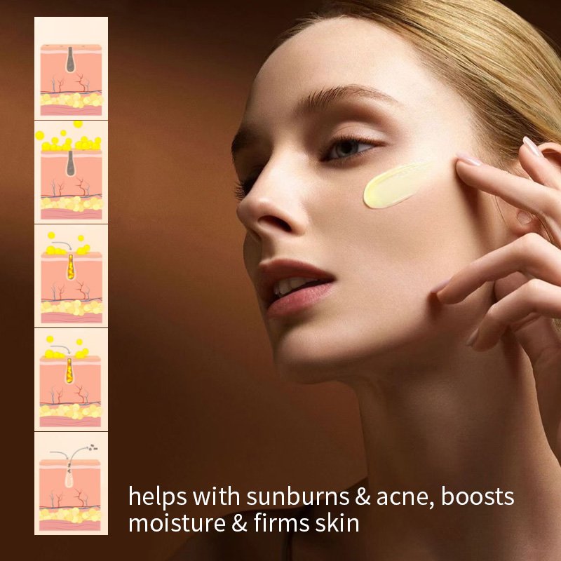 Boost Luster Herbal Whitening And Acne Removal Pimple Anti Acne Turmeric Face Cream