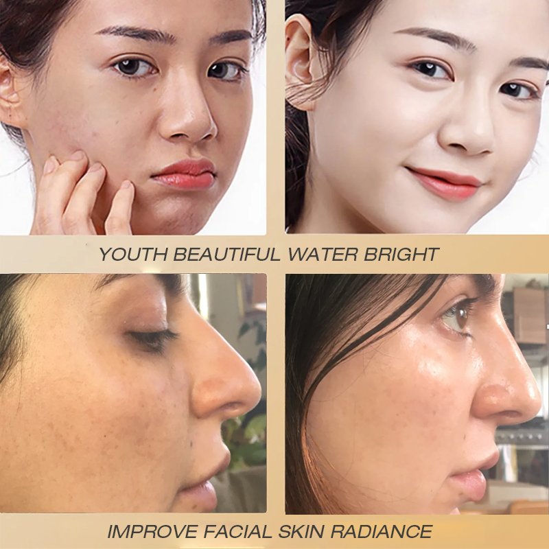 FATAZEN New Arrive Face Cream Face Care Dark Spot Removal Nourishing Beauty Skin Moisturizing Lady Cream Women Skin Face Cream