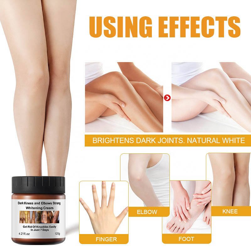 Private Label Best Strong Instant Whitening Cream for Dark Knees Knuckles and Elbows Fast Action Extreme Whitening Cream