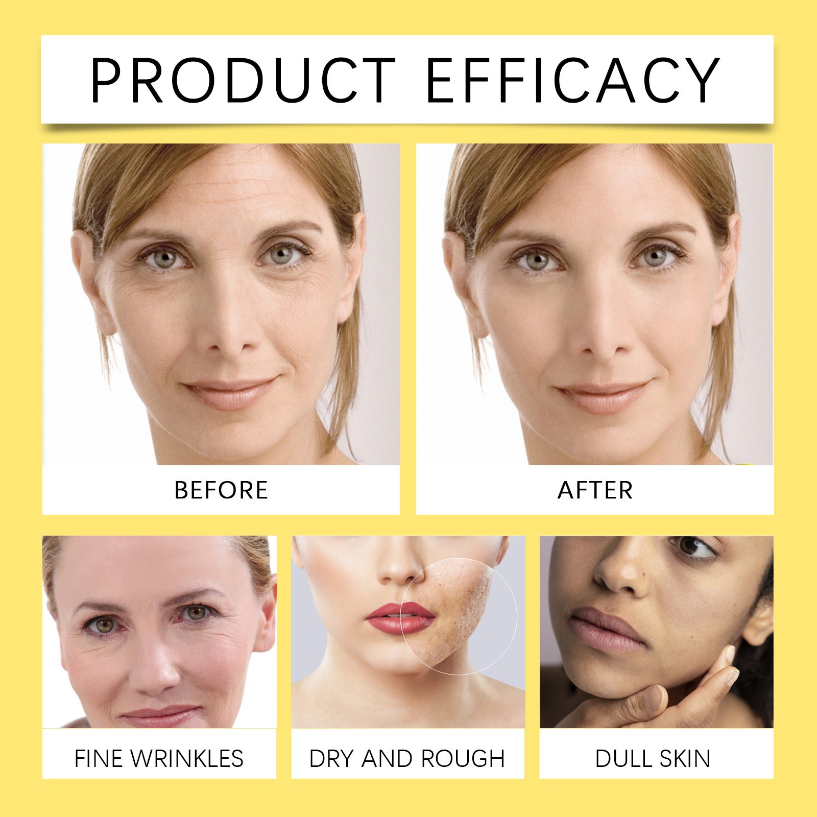 Wholesale Private Label Snail Mucin 92% Moisturizer Daily Repairing Snail Face Cream Whitening Anti Aging Snail All In One Cream