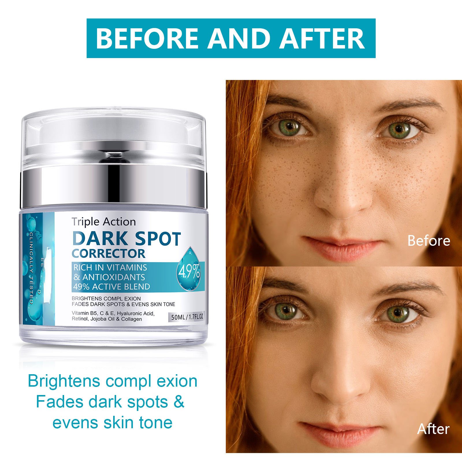 Private Label Removing Whitening Freckle Face Cream Skin Care Dark Spot Corrector Remover Whitening Anti Freckle Cream