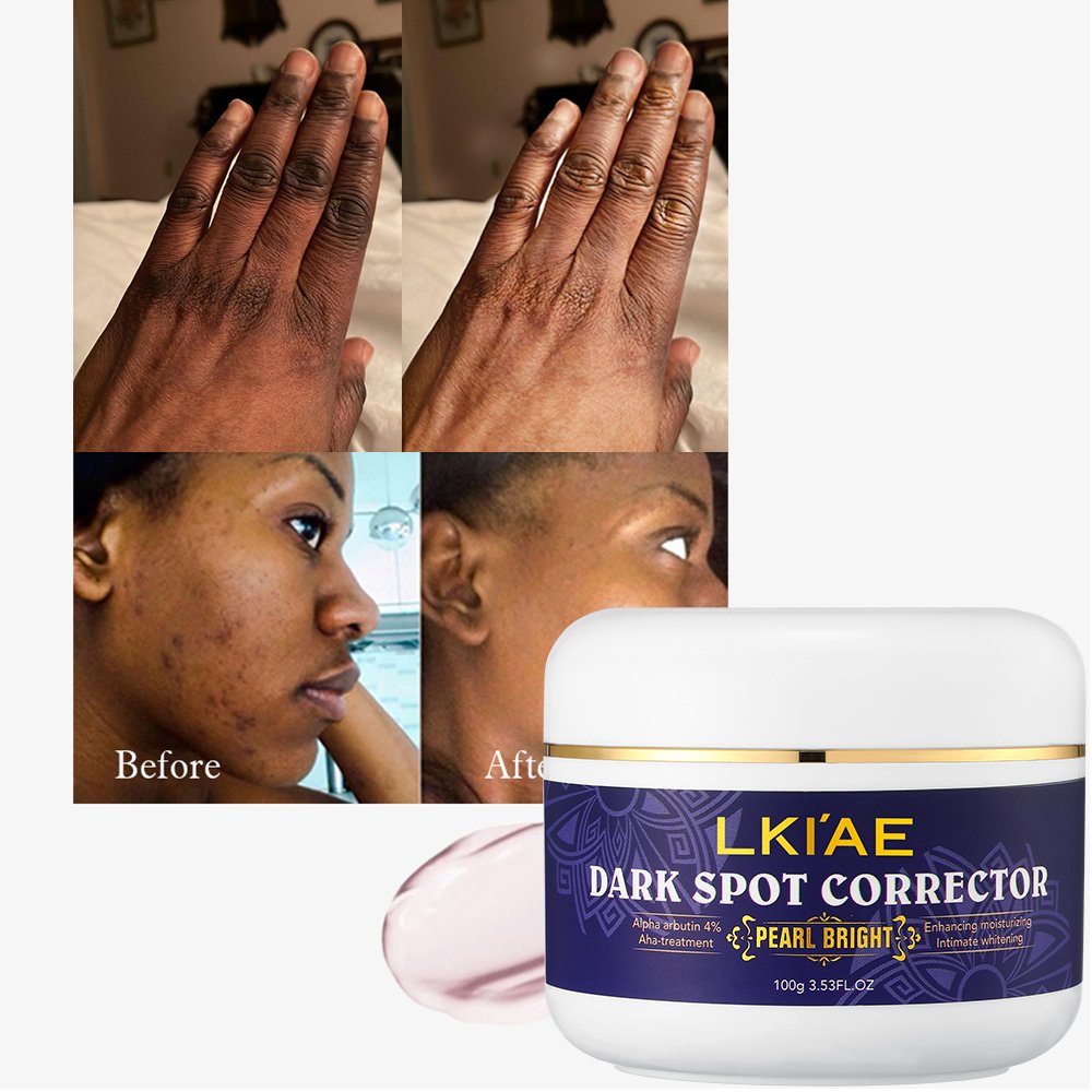 Skin Care Cream strong remover 7 Days Dark Spot cream Corrector Skin Care Private Label Whitening Freckle 100ml Face Cream