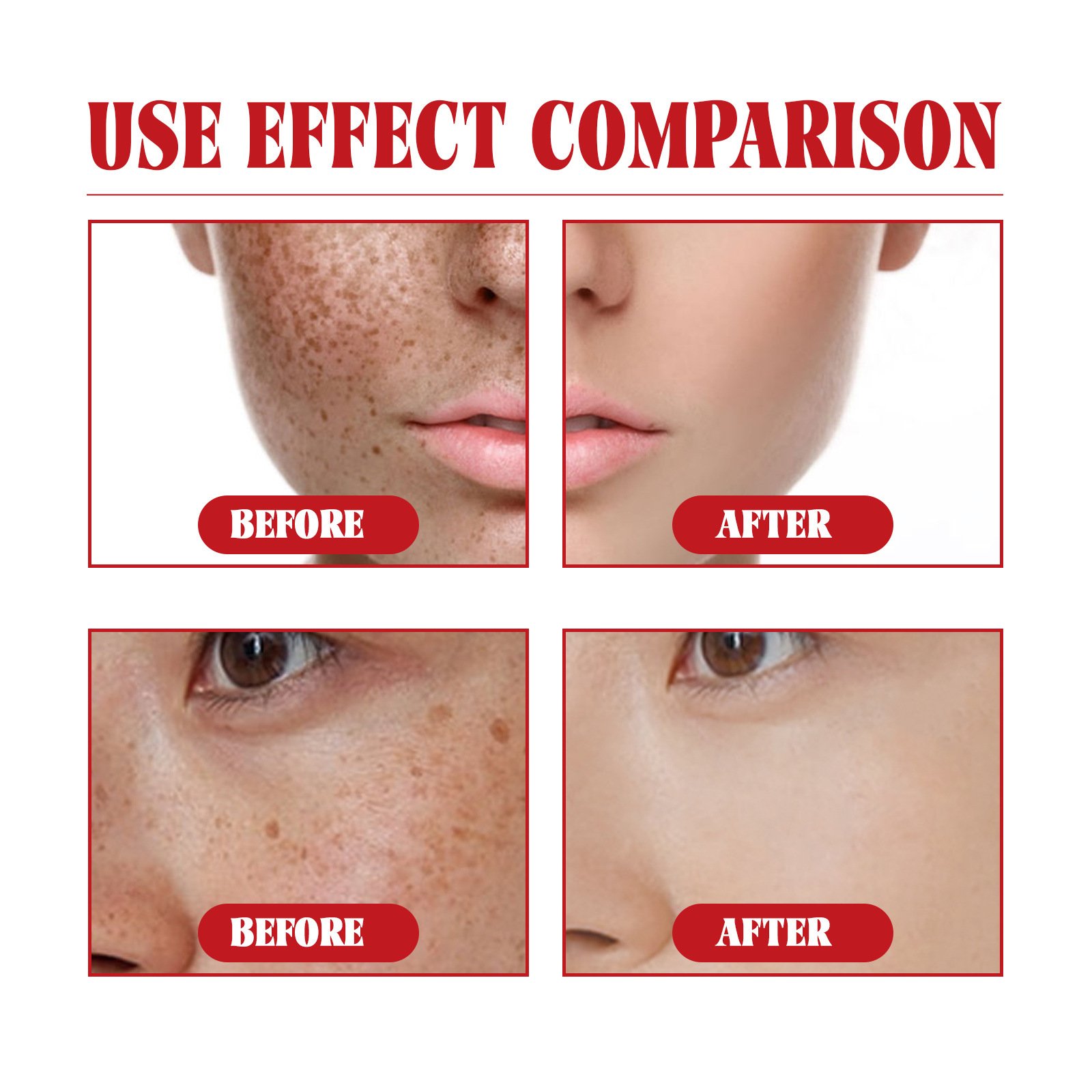 EELHOE Nicotinamide face cream Moisturizing and Moisturizing&Whitening Skin Repairing Melanin Day Cream Night Cream