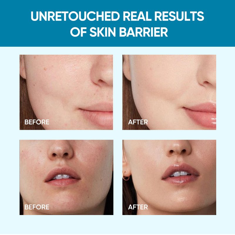 Wholesale 5x Ceramide Barrier Repair Moisturizing And Nourishing Skin Cream With Hyaluronic Acid Centella Face Day Cream