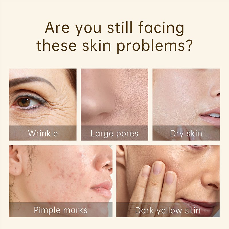 Wholesale private Label collagen snail face cream Moisturizer Whitening Anti-aging Wrinkles snail repairing cream