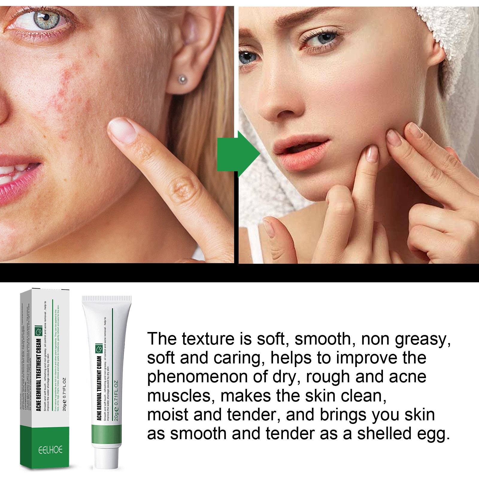 freckle remove anti aging facial lotion melasma dark spot removing corrector whitening face cream