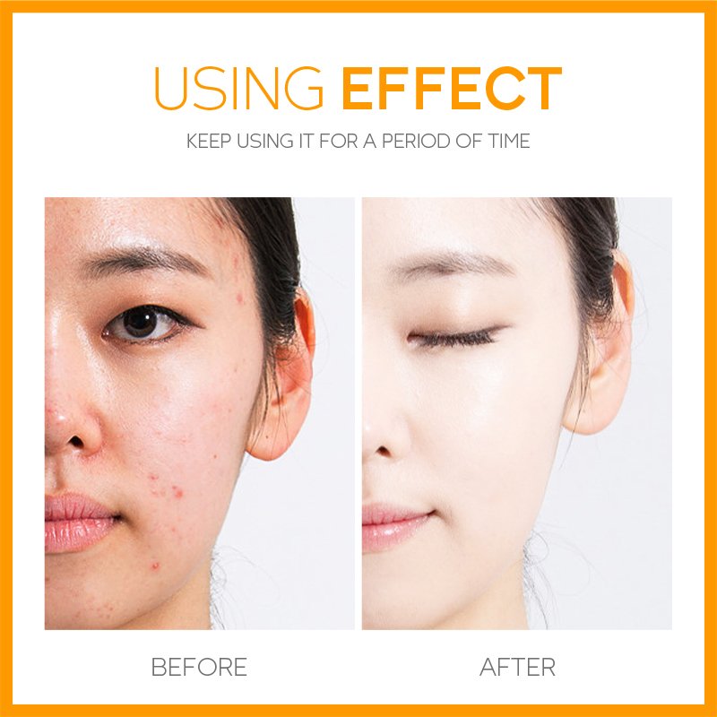 Natural Organic Vegan Moisturizing Brightening Firming Whitening Vitamin C Face Cream