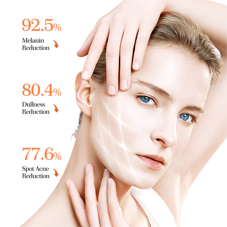 Kojic Acid Strong Whitening Face Cream Anti-aging and Moisturizing the Skin Anti-acne 50g MOOYAM Kojic Acid Facial Cream