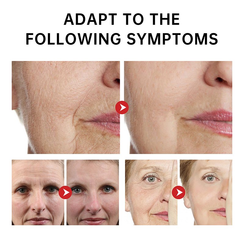 Private label orgnaic collagen face cream Moisturizing Whitening Removing Black Spot Anti-wrinkle Anti-wrinkle cream