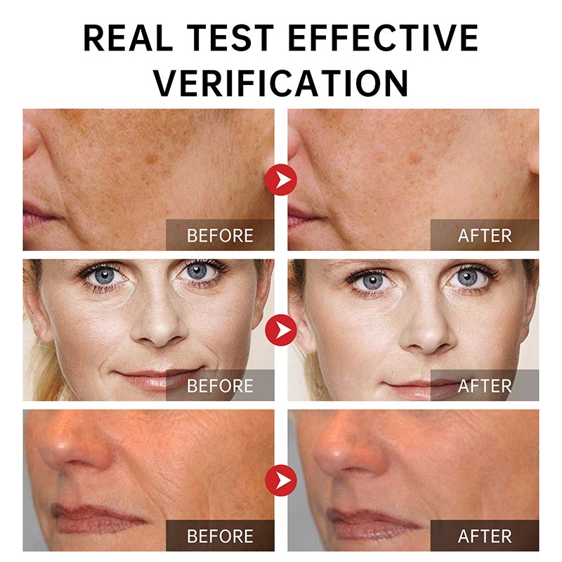 Private label orgnaic collagen face cream Moisturizing Whitening Removing Black Spot Anti-wrinkle Anti-wrinkle cream
