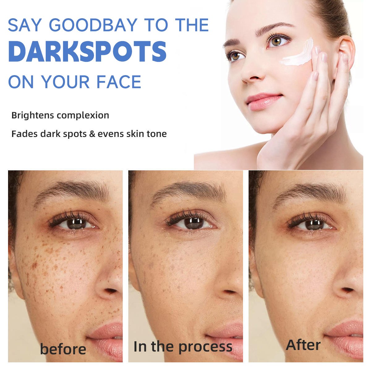 OEM ODM Whitening Anti-freckle Cream Lighten Reduce Spots Removing Pigmentation and Melanin Fade Melanin Face Cream