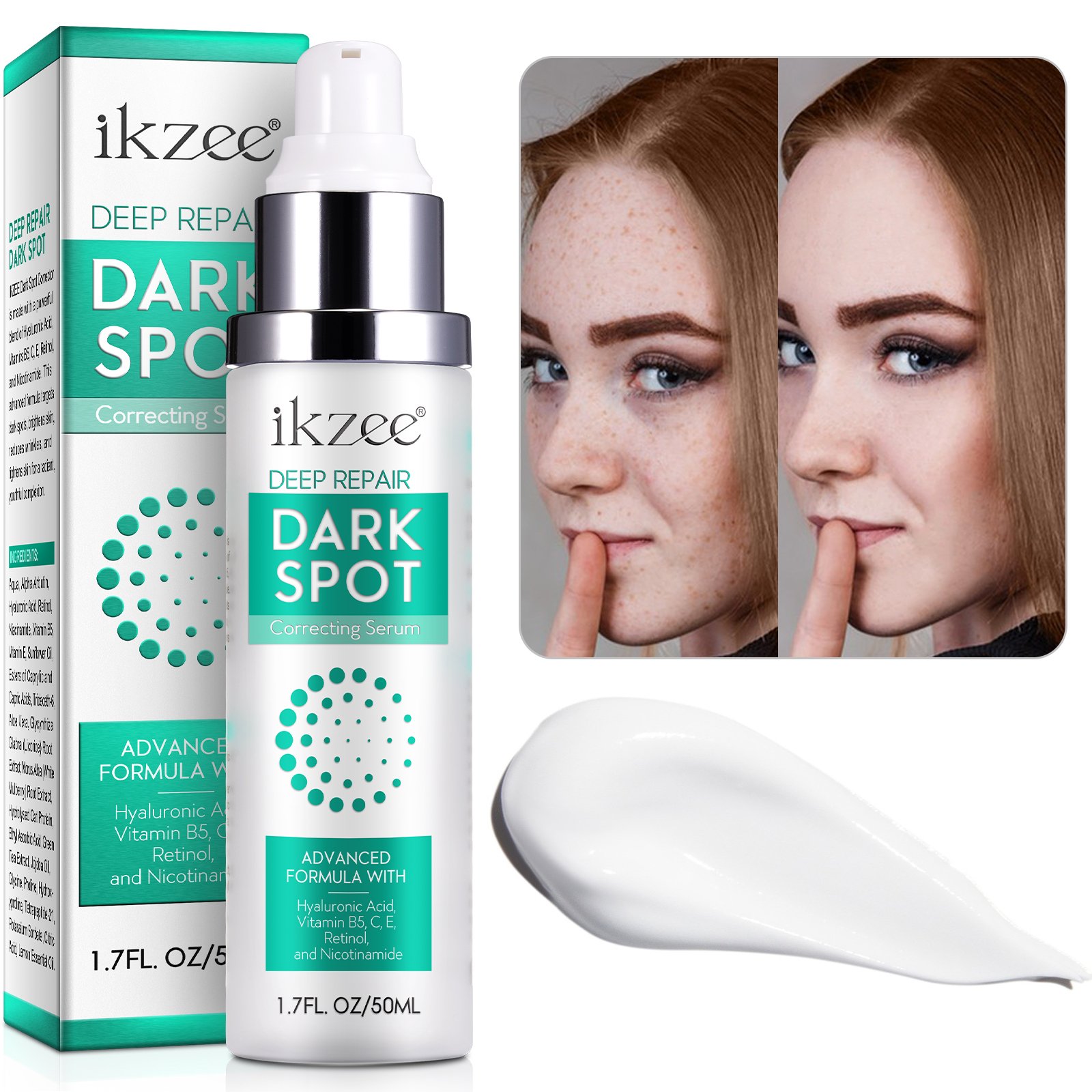 IKZEE retinol niacinamide 50ml deep repair brightens skin reduces wrinkles tightens skin dark spot corrector remover face cream