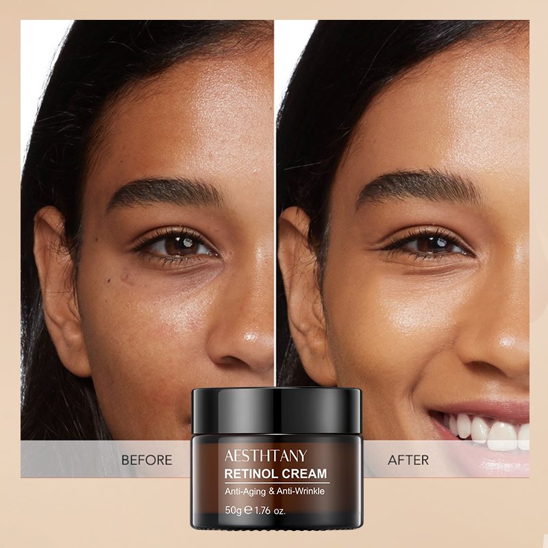 Retinol Antiaging Cream Moisturizer Anti Aging Cream Anti Aging Face Neck Reduce Wrinkle Retinol SKin Care Face Cream
