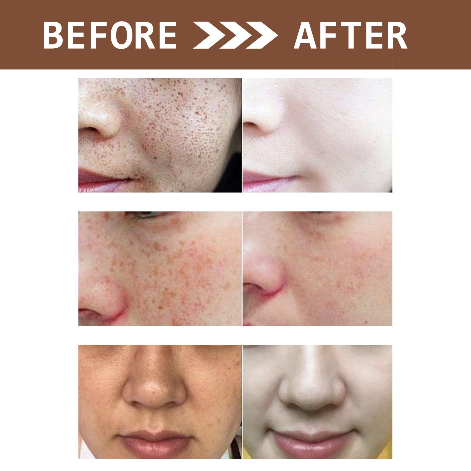 Best selling Face cream Potent skin whitening intensive Lightening Spots Moisturizing Brightening Face cream
