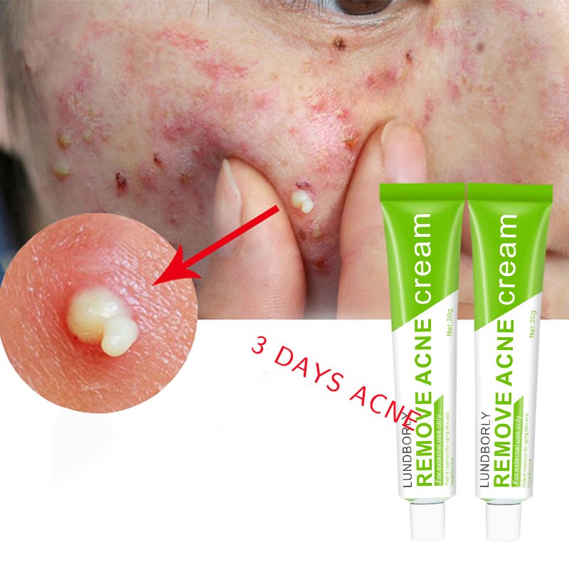 Skin Care Phyto Corrective Green 3 Days Herbal Salicylic Acid Anti Acne face cream