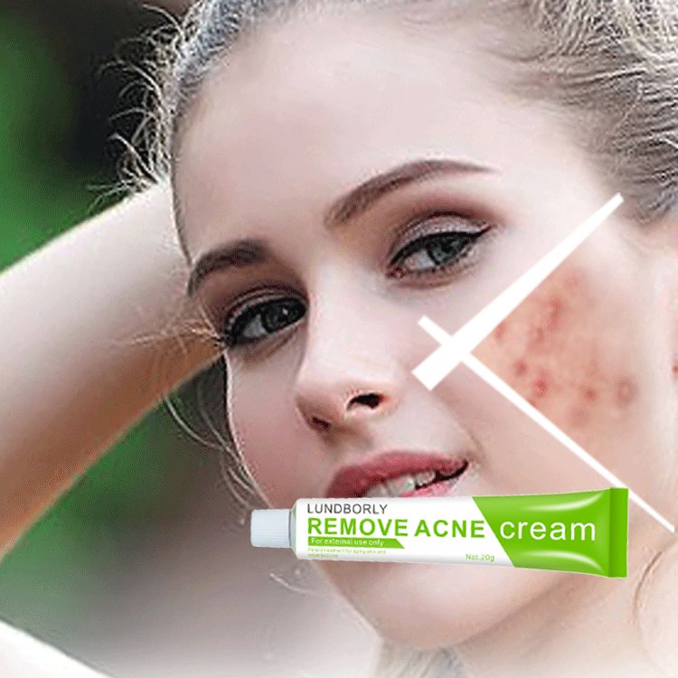 Skin Care Phyto Corrective Green 3 Days Herbal Salicylic Acid Anti Acne face cream