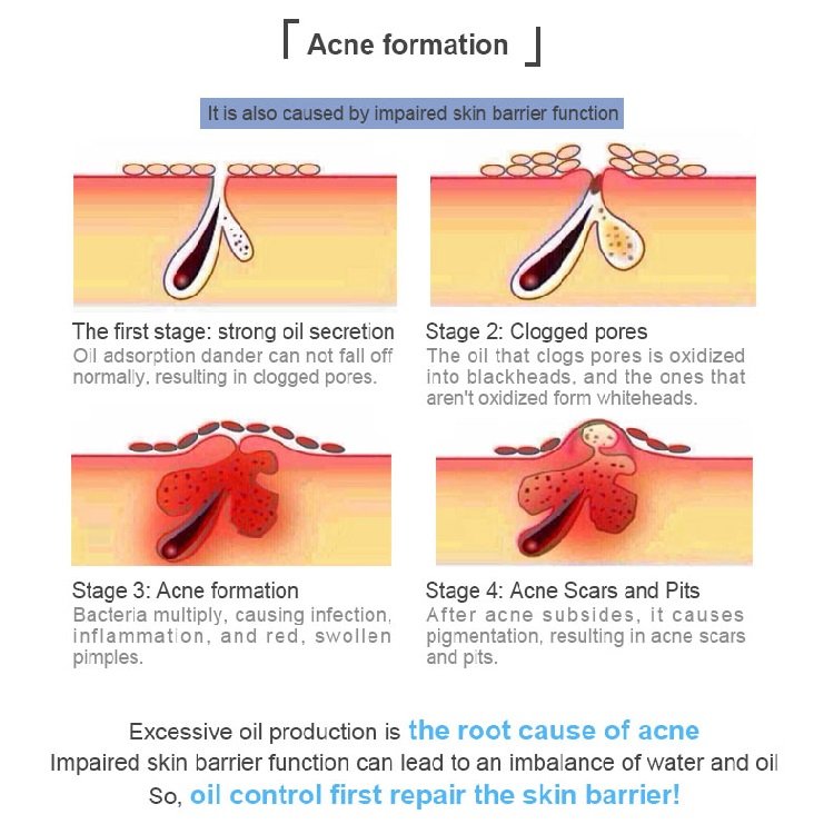 Medical Skincare Face Cream After Medical Cosmetology Relieve Skin Redness and Swelling Collagen Cream For Sensitive Skin Type