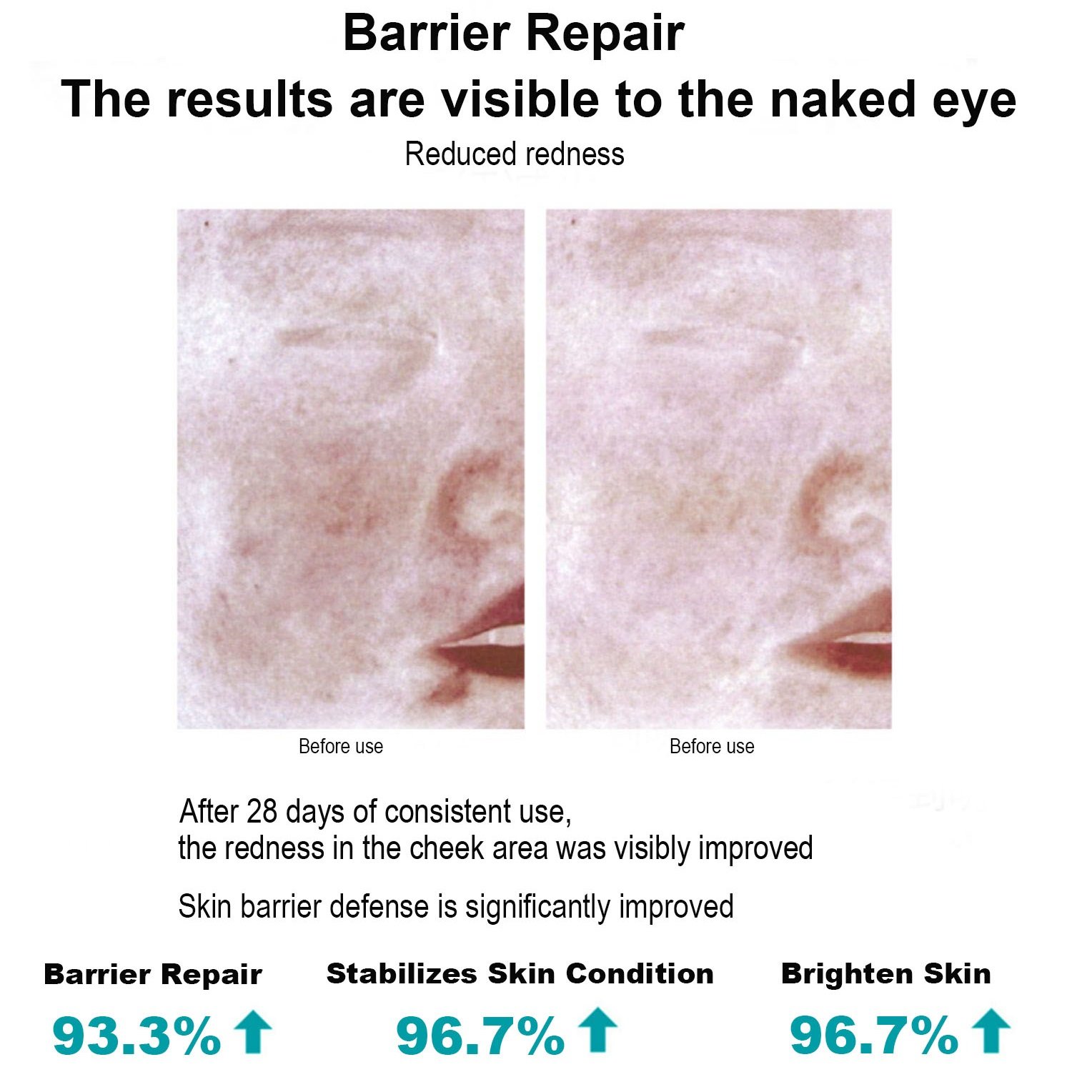 Medical Skincare Face Cream After Medical Cosmetology Relieve Skin Redness and Swelling Collagen Cream For Sensitive Skin Type