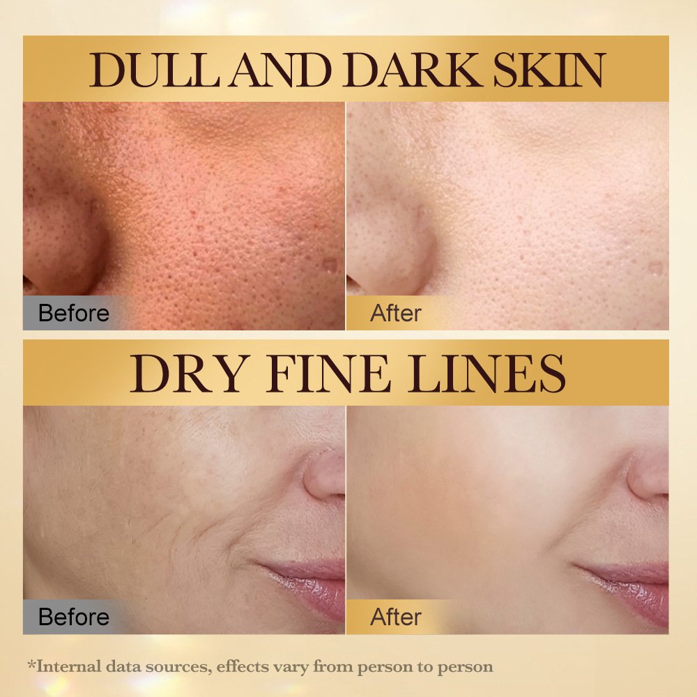 Bee venom anti wrinkle firming nourishing skin beautifying and moisturizing face cream