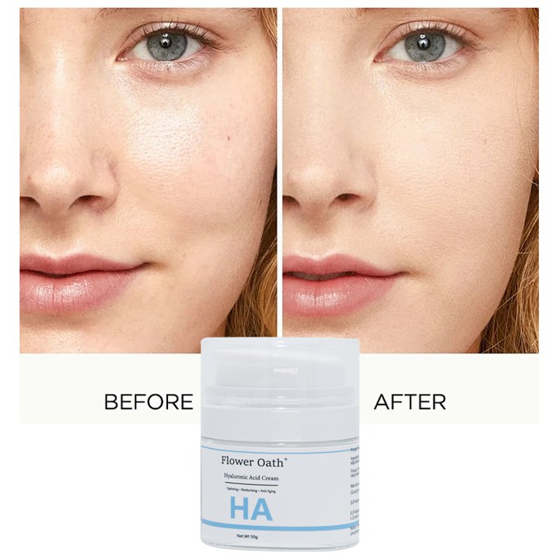 Dubai's Best Retinol and Whitening Face Cream for Men with Anti-Wrinkle and Glowing Hyaluronic acid face cream