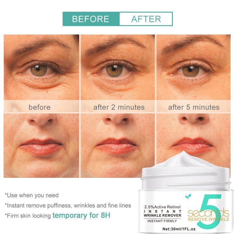 Private label active retinol instant wrinkle remover cream 5 seconds lifting firming anti aging face cream