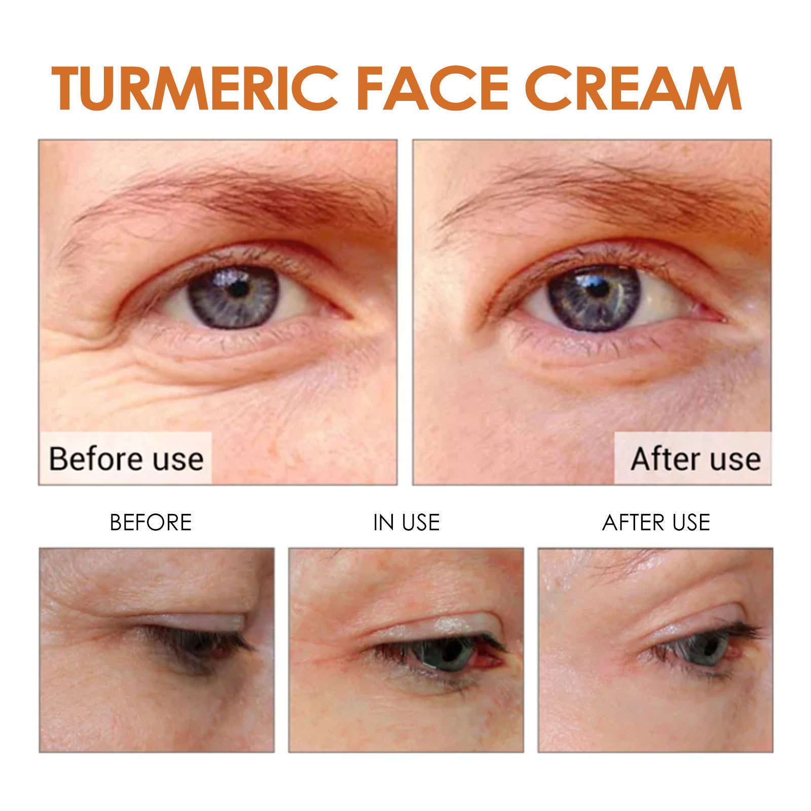 Bettermiss Private Label Organic Turmeric Cream Anti Acne Strong Effect Whitening Turmeric Face Cream For Acne Treatment