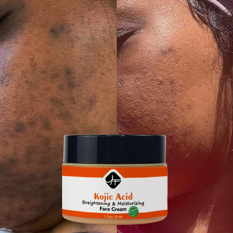 Best selling Private Label Natural Whitening Face Cream Vitamin C &Kojic Acid Skin Care Acne Function KOJIC Brightening CREAM