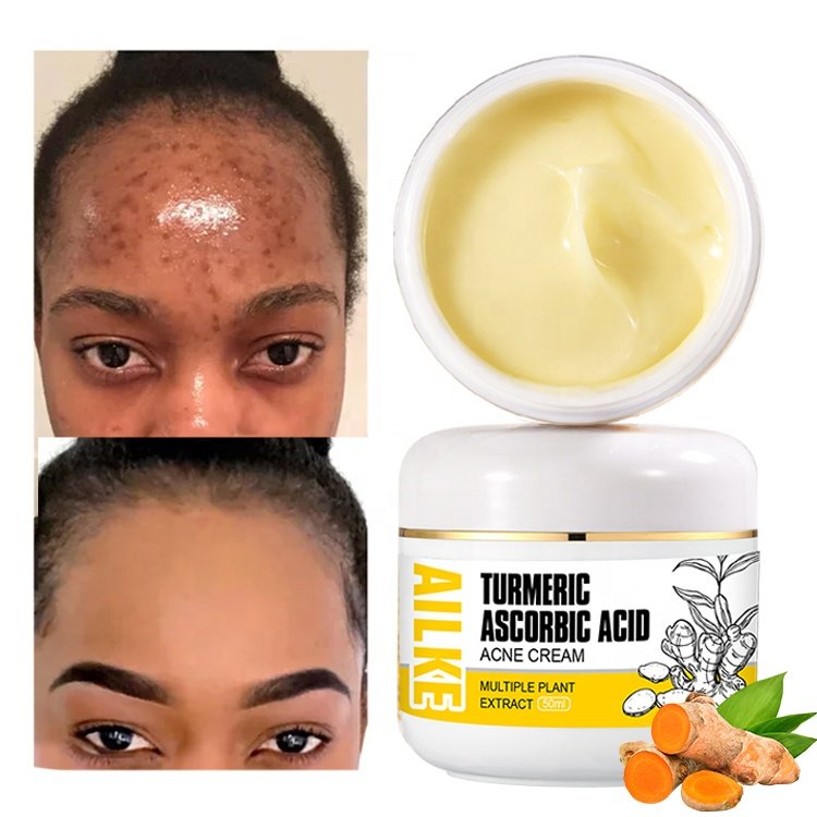 OEM/ODM Strong Effective Tumeric Fade Acne Scar Glowing Whitening Face Cream For Pimple Removal Oil Control Reduce Blackheads