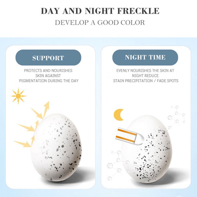 Private Label Freckle Removal Face Cream Strong Bleaching Whitening dark spot remover cream