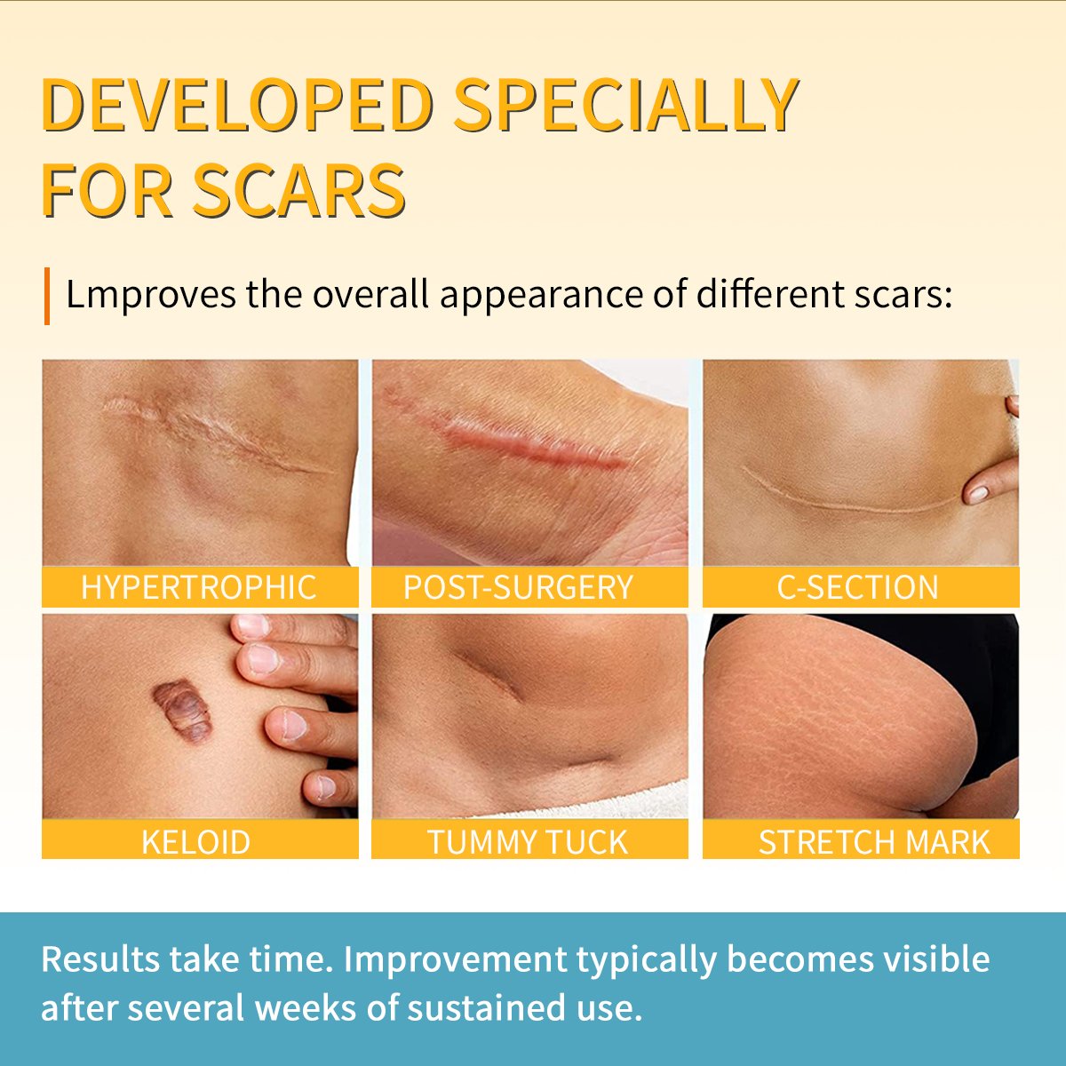 Remove Scars Private Label Skin Care Dark Spot Repair Gel Face Pimples Acne Scar Mark Removal Cream For Acne