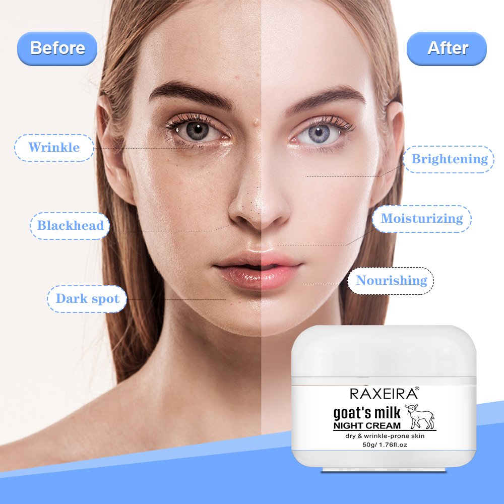 Best Sale skin care natural goat milk face whitening cream goats milk face cream skin white goat milk whitening cream