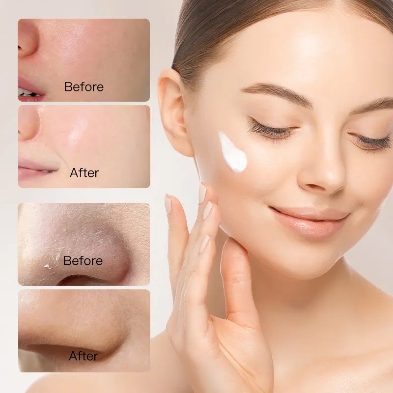 Private Label Skin Care Anti Aging Moisturizing Face Cream Face Firming Whitening Creams Donkey Milk Face Cream