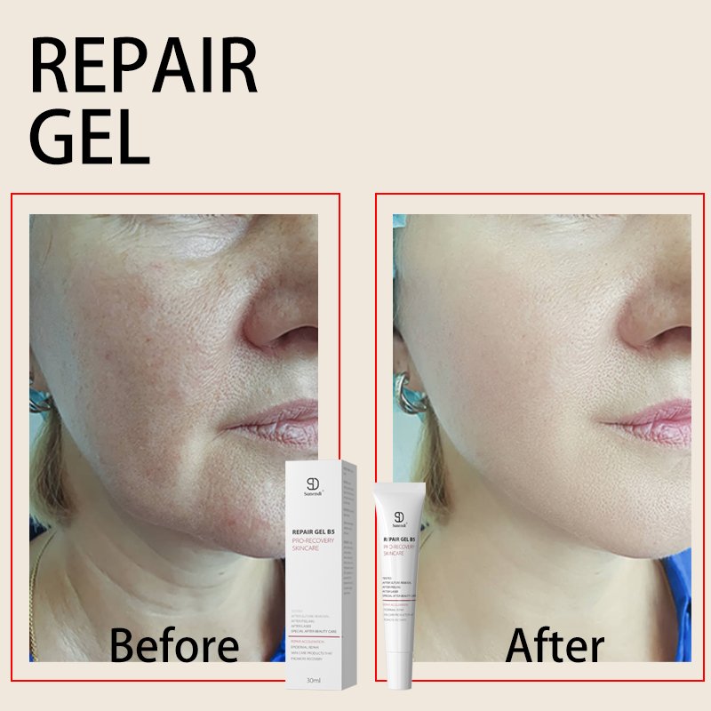 B5 Maximumturmeric face cream for acne treatment Repair PRO-RECOVERYSKINCARE acne scar treatment cream Soothing