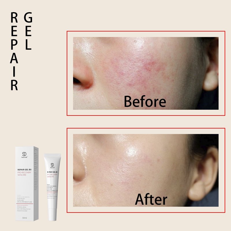 B5 Maximumturmeric face cream for acne treatment Repair PRO-RECOVERYSKINCARE acne scar treatment cream Soothing