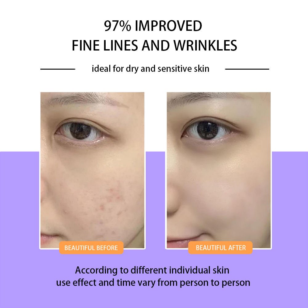 Private Label Anti Wrinkle Hyaluronic Acid and Vitamin E Cream Face Cream