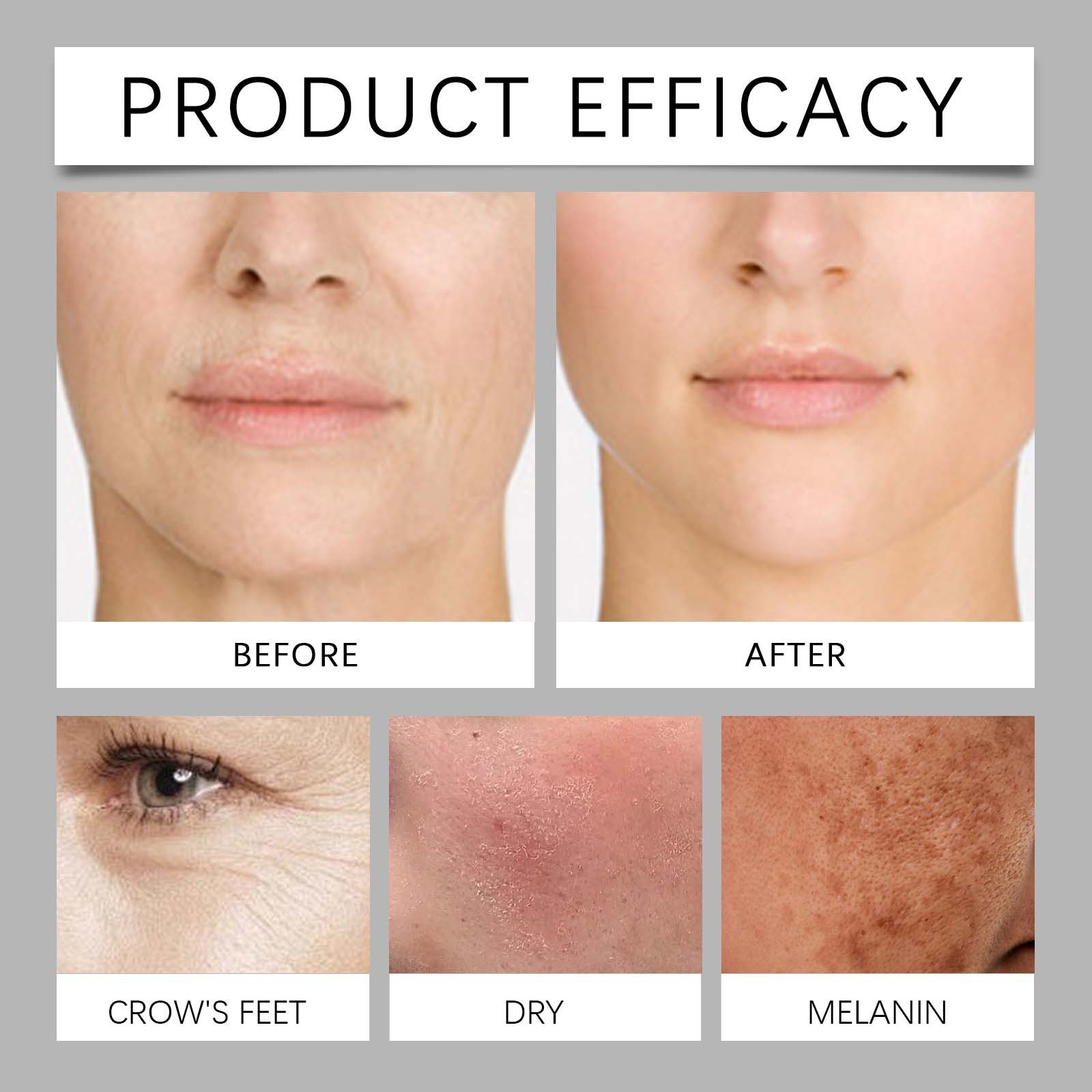 Private label Anti Aging Wrinkle Face Moisturizing VC Retinol Cream Luxury Hyaluronic Acid Anti Wrinkle Face Cream