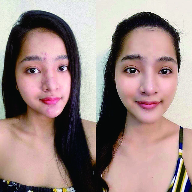 C9 Thailand Vitamin C Face Cream Moisturizing Acne Treatment Cream for Clear Skin 15g Helps Remove Acne and Lighten Skin