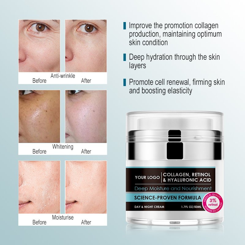 Private Label Anti Aging Wrinkle Removal Dark Spot Bleaching Whitening Collagen Retinol Vitamin C Face Cream Freckle Cream