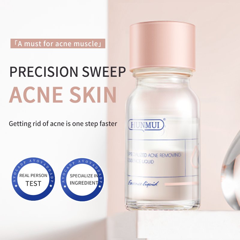 Facial Skin Care Face Cream Whitening And Acne Removal Pimple Face Anti Acne Cream