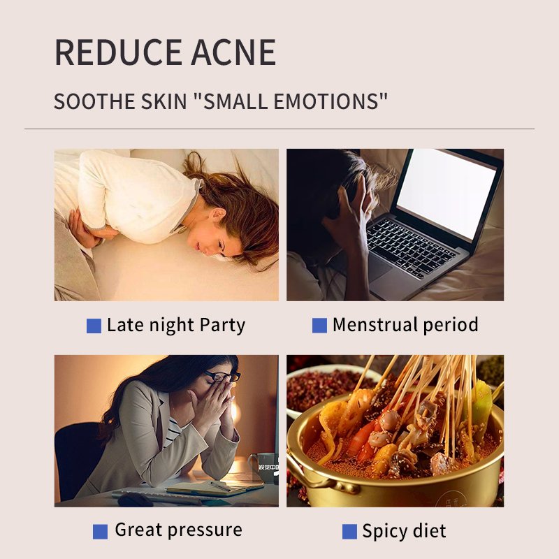 Facial Skin Care Face Cream Whitening And Acne Removal Pimple Face Anti Acne Cream