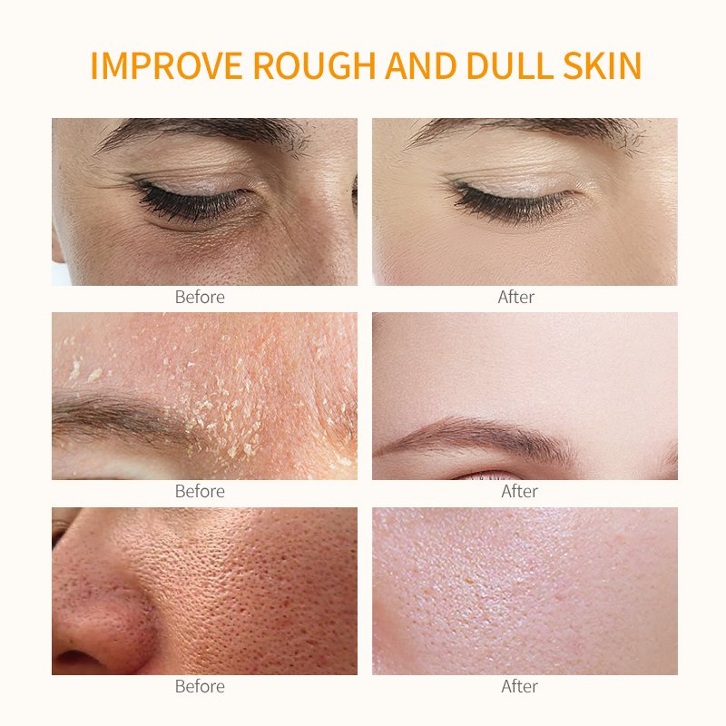Brightening Antiaging Vitamin c Facial Cream Skin Care Moisturizer Whitening Anti Aging Face Cream